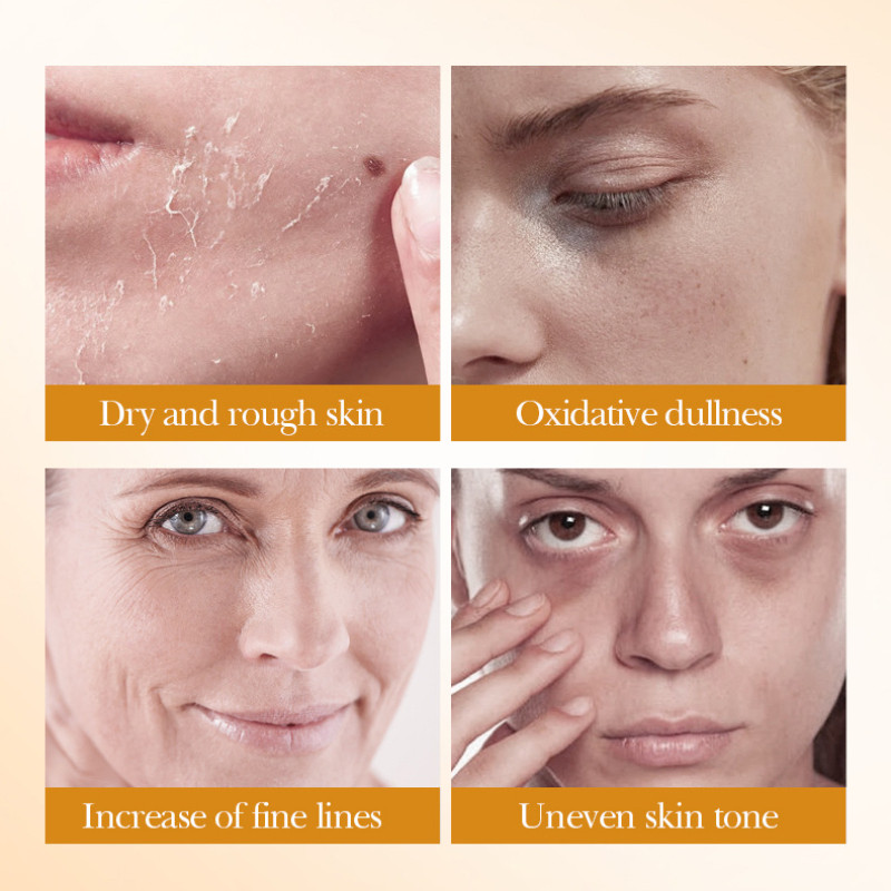 5pcs BIOAOUA Rice Raw Whitenin - Luxury Skincare Kit ulasan dan harga