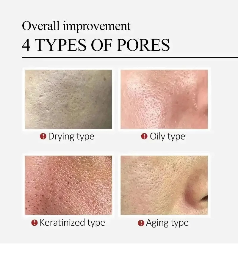 Centella Asiatica Shrink Pores - Luxury Skincare Korea ulasan dan harga